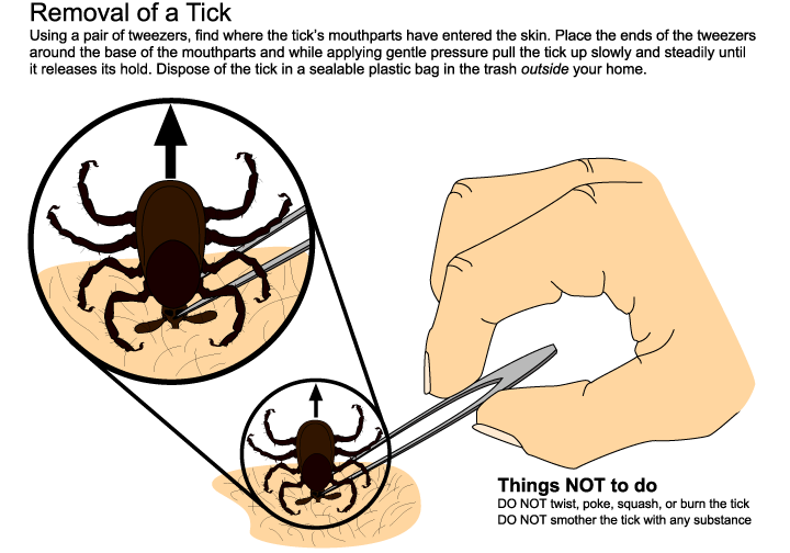 Safe removal of a tick can help reduce chances of infection. (Graphic: Purdue)